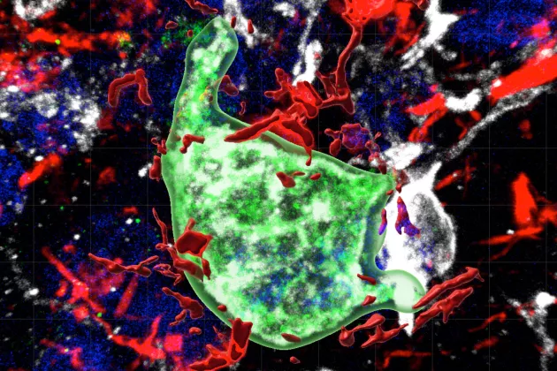 A Galectin-3-expressing microglia in green close to Tau in red. Image. 