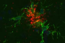 A photo from the microscope showing in green microglial cells close to the accumulated beta-amyloid in red. 